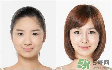 保妥适瘦脸针多少钱?botox瘦脸针一般价格