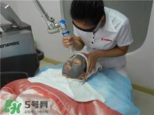 黑脸娃娃是什么？黑脸娃娃的效果好不好？