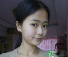 埋线双眼皮需要拆线吗？埋线双眼皮怎么拆线