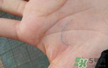 埋线双眼皮需要拆线吗？埋线双眼皮怎么拆线