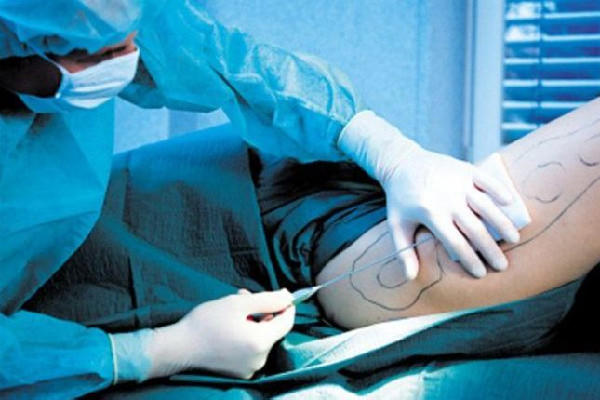 武汉吸脂手术哪个医院比较好 武汉吸脂手术要多少钱