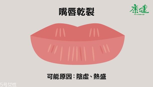 ​嘴唇发黑发紫是什么原因 6种唇色解读