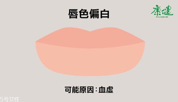 嘴唇发黑发紫是什么原因 6种唇色解读