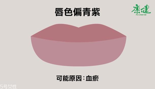 ​嘴唇发黑发紫是什么原因 6种唇色解读