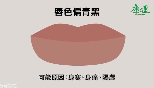 ​嘴唇发黑发紫是什么原因 6种唇色解读