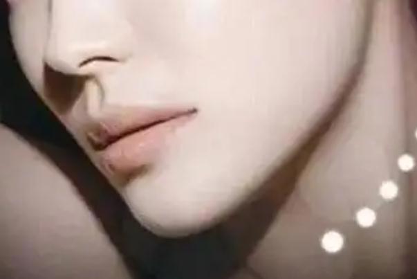 玻尿酸丰下巴注意事项 玻尿酸丰下巴打完几天最好看