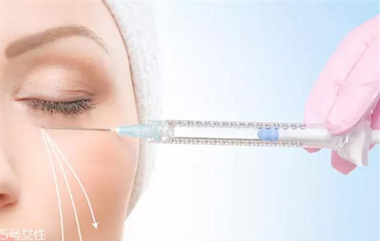 瑞蓝玻尿酸有几个型号 瑞蓝玻尿酸介绍