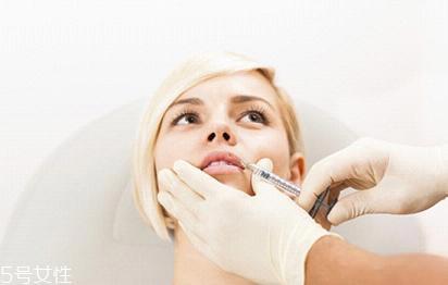 瑞蓝玻尿酸有几个型号 瑞蓝玻尿酸介绍