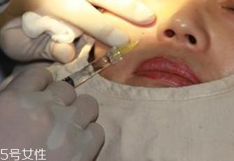 玻尿酸分哪几种 不同种类玻尿酸怎么挑选