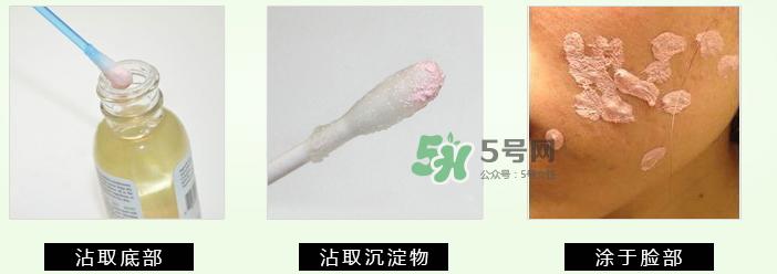 mario badescu祛痘精华怎么用?mario祛痘精华用法