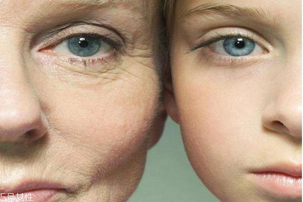 除皱针是什么 除皱针维持多久