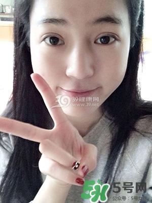 什么是定点双眼皮？定点双眼皮多少钱？