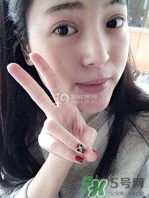 什么是定点双眼皮？定点双眼皮多少钱？