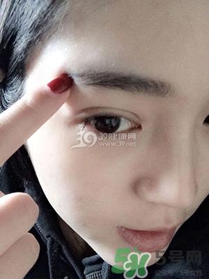 什么是定点双眼皮？定点双眼皮多少钱？