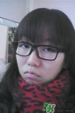 什么是定点双眼皮？定点双眼皮多少钱？
