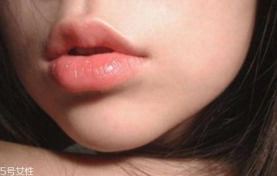 玻尿酸丰唇效果如何 玻尿酸丰唇后注意事项