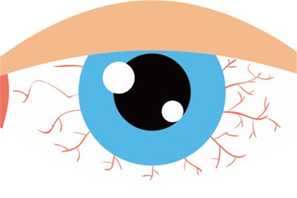 眼睛里有血丝怎么消除 眼睛里有血丝有什么危害