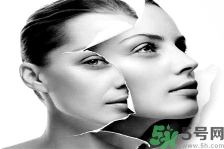 点痣后有红印怎么办？点完痣后留下红印和坑怎么修复？