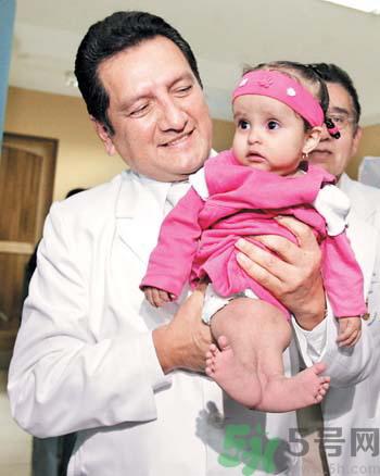 妈妈怀上人鱼宝宝 什么是美人鱼综合症？