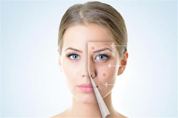 面部提升是什么 面部提升有效果吗