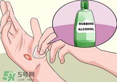 水泡怎么处理？水泡要不要刺破？