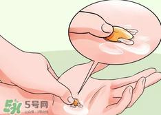 水泡怎么处理？水泡要不要刺破？