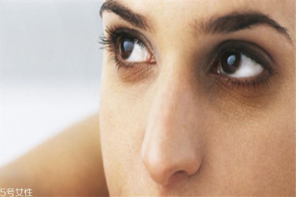 黑眼圈和眼袋有什么区别 黑眼圈和眼袋的区别