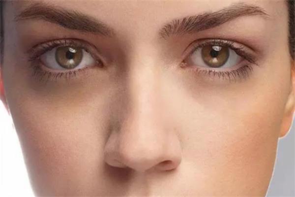 黑眼圈和眼袋有什么区别 黑眼圈和眼袋的区别