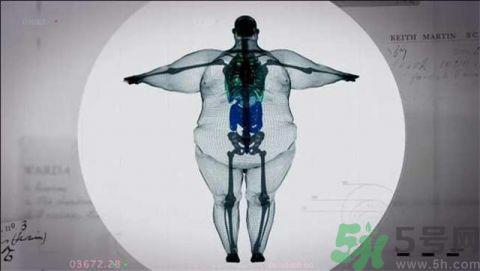 900斤胖子X光扫描照片惊人 过度肥胖会有什么危害?