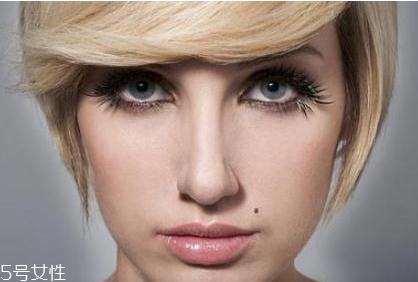 黑痣是怎么形成的？防范黑色毒瘤