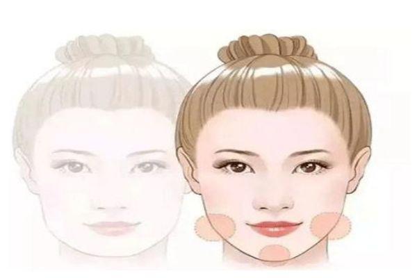 打一次除皱针可以维持多久呢 一针除皱针需要多少钱呢