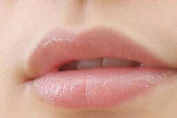 女生长小胡子的原因 女生长小胡子是雄激素偏高吗