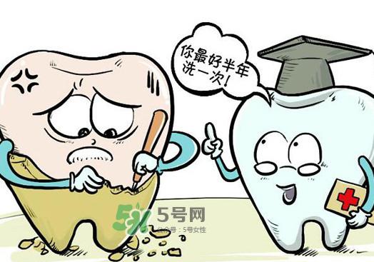 洗牙多少钱一次 洗牙多久洗一次比较好