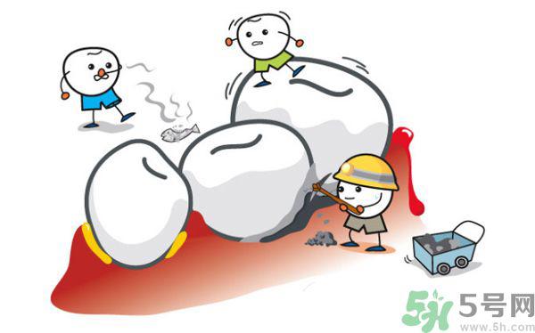 牙龈出血是怎么回事？牙龈出血怎么办？