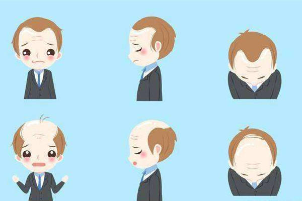 发际线几种形状 发际线什么样的比较好