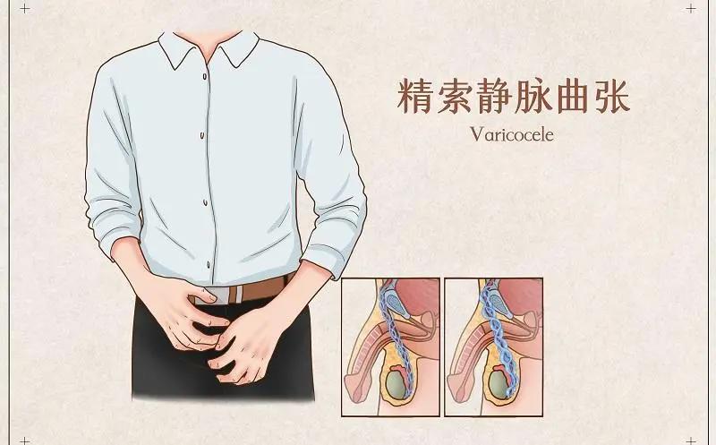 男性得性疾病后八大症状图片，警惕梅毒/淋病/尖锐湿等