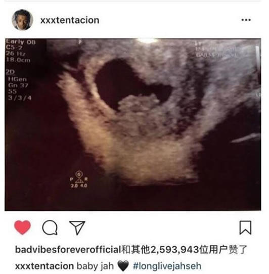 xxxtentacion的孩子吗 XXXtentacion惹了谁