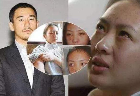张默打童瑶到底真相是什么 张默打童瑶事件