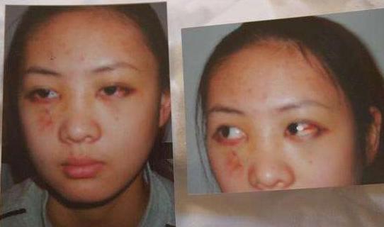 张默打童瑶到底真相是什么 张默打童瑶事件