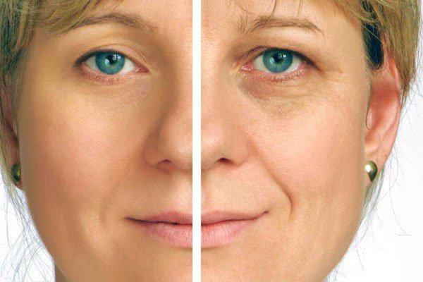 怎样去掉抬头皱纹,抬头皱纹怎么消除