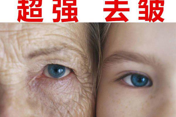怎样去掉抬头皱纹，抬头皱纹怎么消除