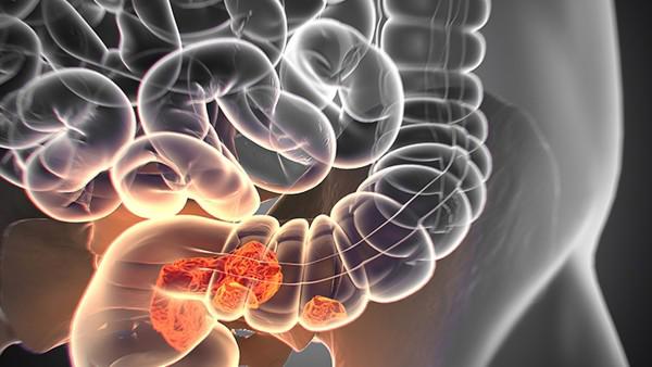 大量不保留灌肠有什么作用？大量不保留灌肠可以治疗便秘吗？