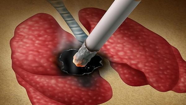 吸烟对身体有哪些危害 吸烟引起的危害有哪些