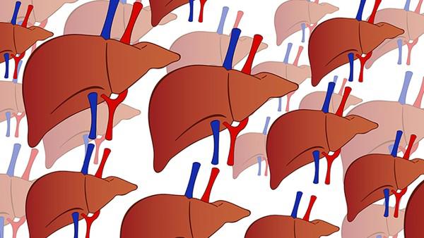 脂肪肝的原因是什么？如何才能摆脱脂肪肝？