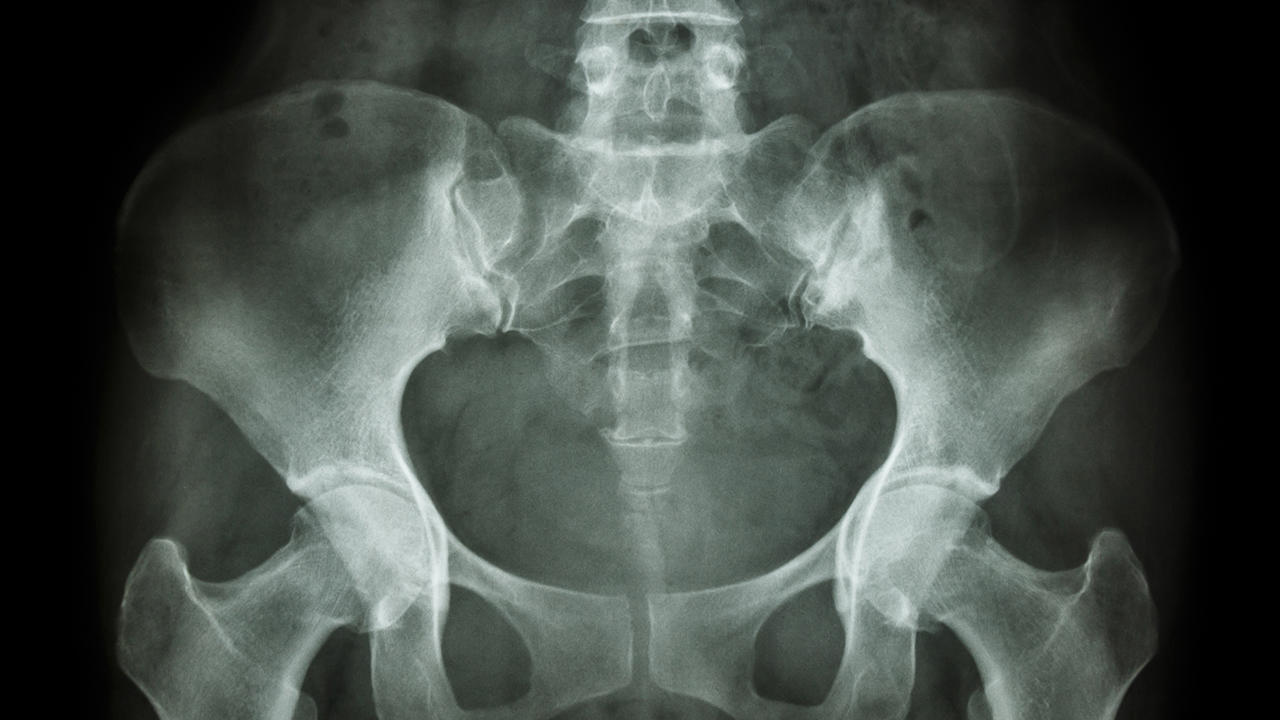 手指关节炎常见哪些症状？关节炎有哪些具体分型？