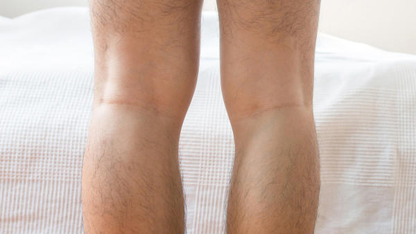 要如何治疗重症肌无力？盘点重症肌无力的5大疗法