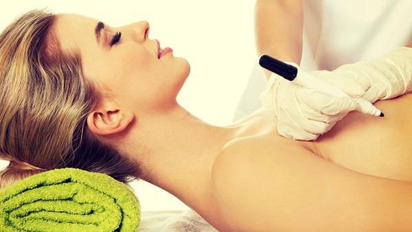 激光祛痘印多久能恢复正常皮肤？激光祛痘印的危害与效果