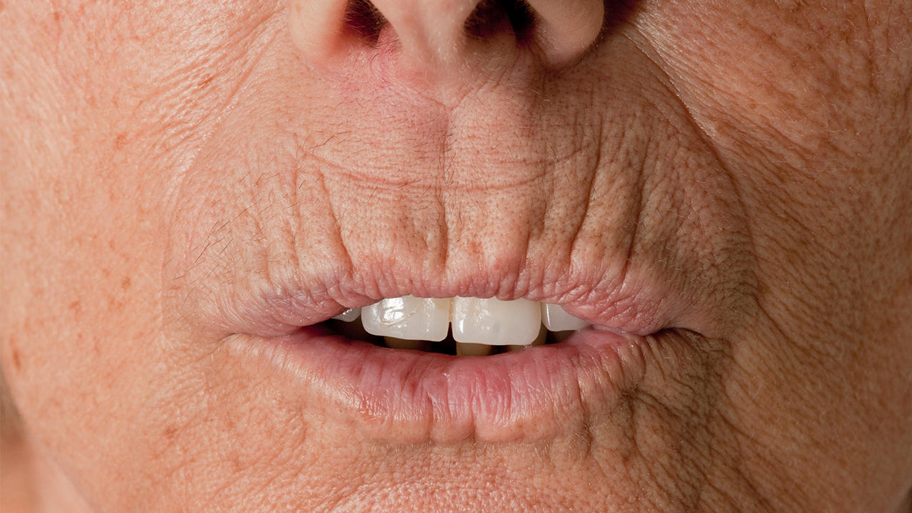 美容养颜饮食有哪些？美容养颜饮食都有什么