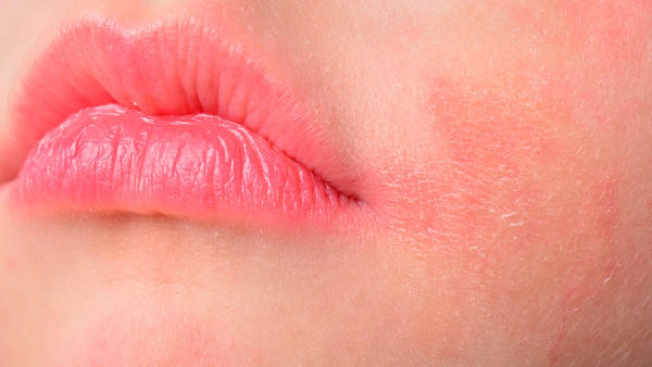 唇部去角质方法有什么？唇部去角质办法有什么