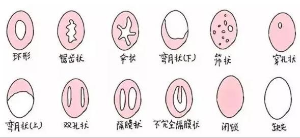 第一次啪男朋友说找不到入口，男朋友找不到位置怎么办